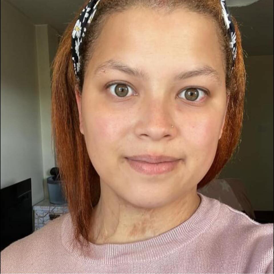 A Woman From Swindon Has Pleaded Guilty To Assaulting A Paramedic And Escaped A Jail Sentance