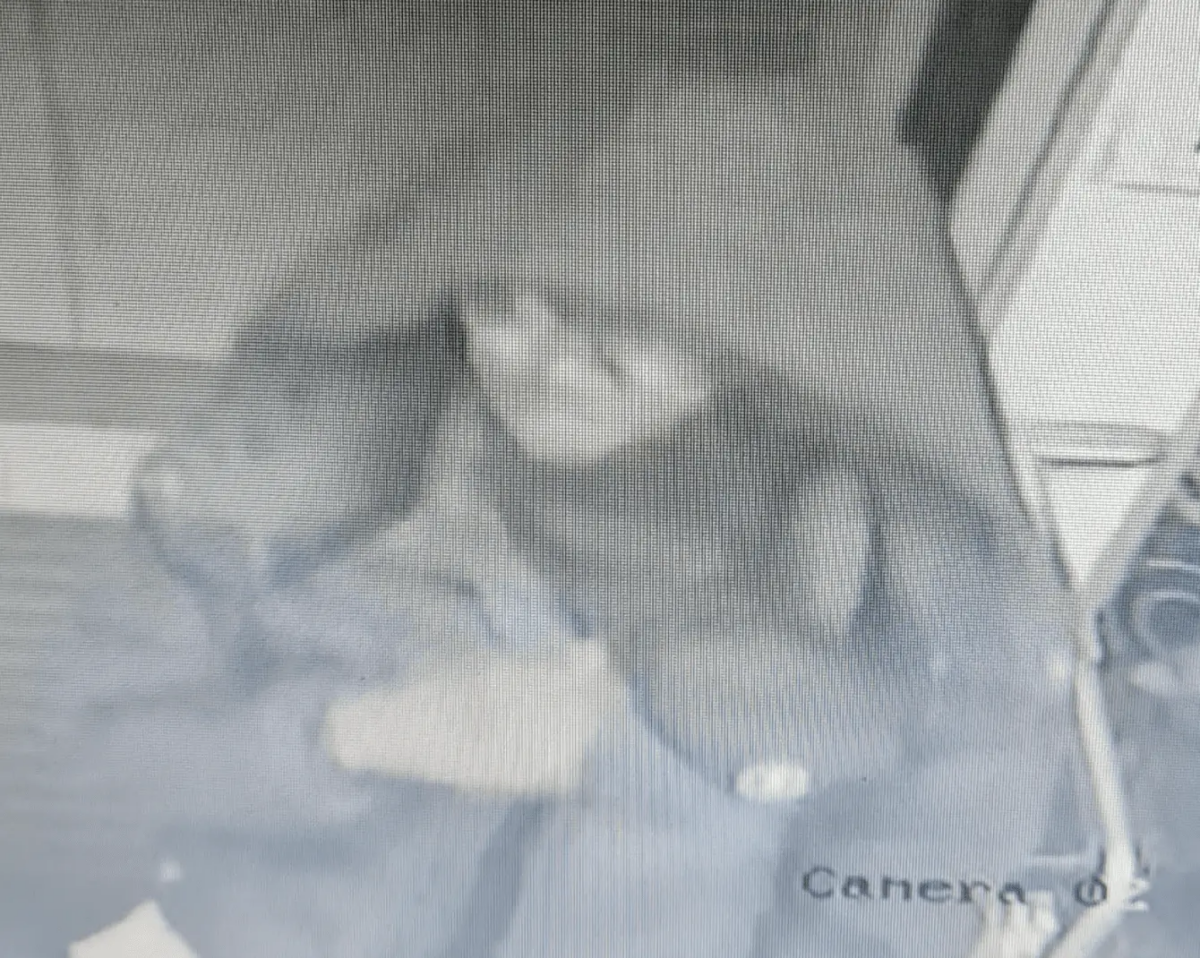 Teen Stabbed at Sutton Station: Police Release CCTV to Catch Attacker