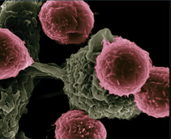 The Scottish Government Is Set To Call Up 13,000 Patients For Further Medical Investigation Following A Widescale Audit Of The Country’s Cervical Screening Programme