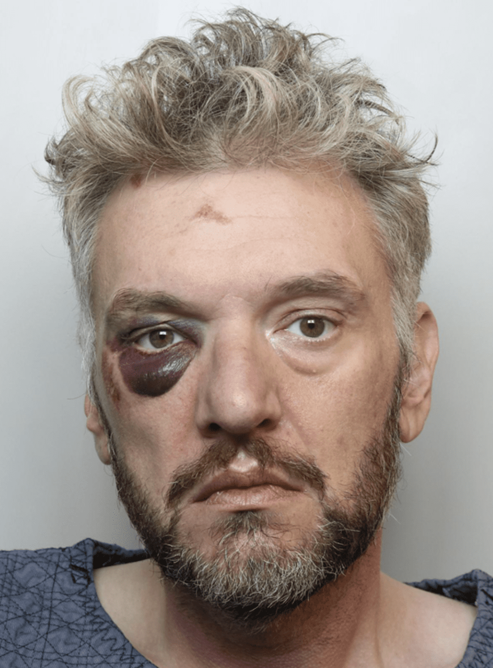 A Man Who Deliberately Drove Into A Motorcyclist During An Incident In Dinton Has Been Given A Hospital Order Under Sections 37 And 41 Of The Mental Health Act 1983