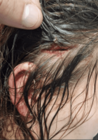 Brick-wielding Thug Attacks Fearless Officer: The Incredible Frontline Reality For Our Unsung Blue Heroes