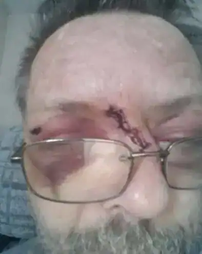 Whitefield Man Seriously Injured in Brutal Garden Attack – Police Seek Witnesses