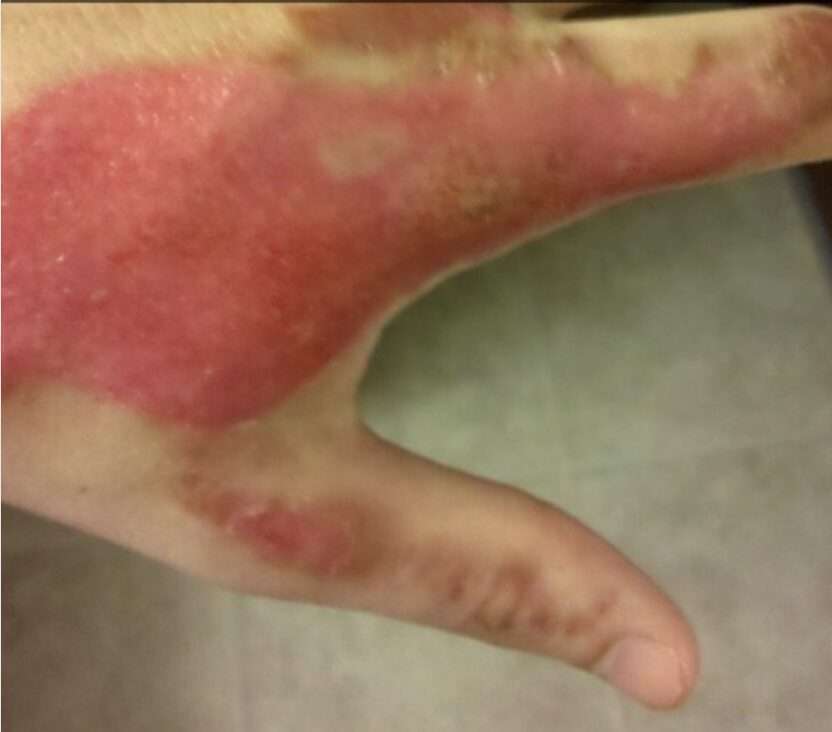 Mother In Law Of The Smithy Family Has Offered A £5,000 Reward Leading To The Arrest Of The Two People Who Set Fire To The Families Car