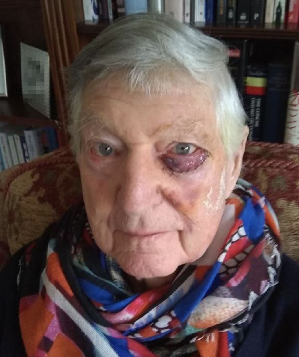 Appeal To Locate 90-year-old Man Who Is Missing  From Sevenoaks