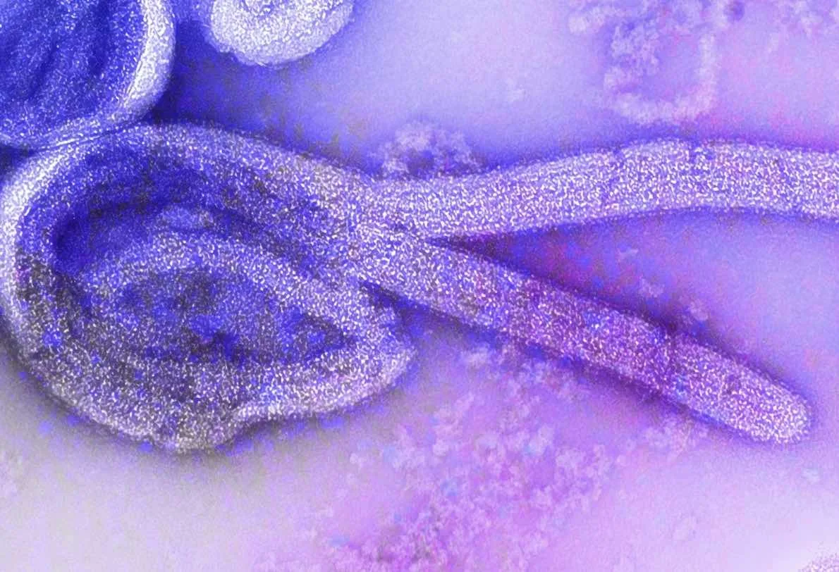 A New Case Of Ebola Virus Infection Has Been Confirmed In The City Of Beni In Eastern Democratic Republic Of Congo