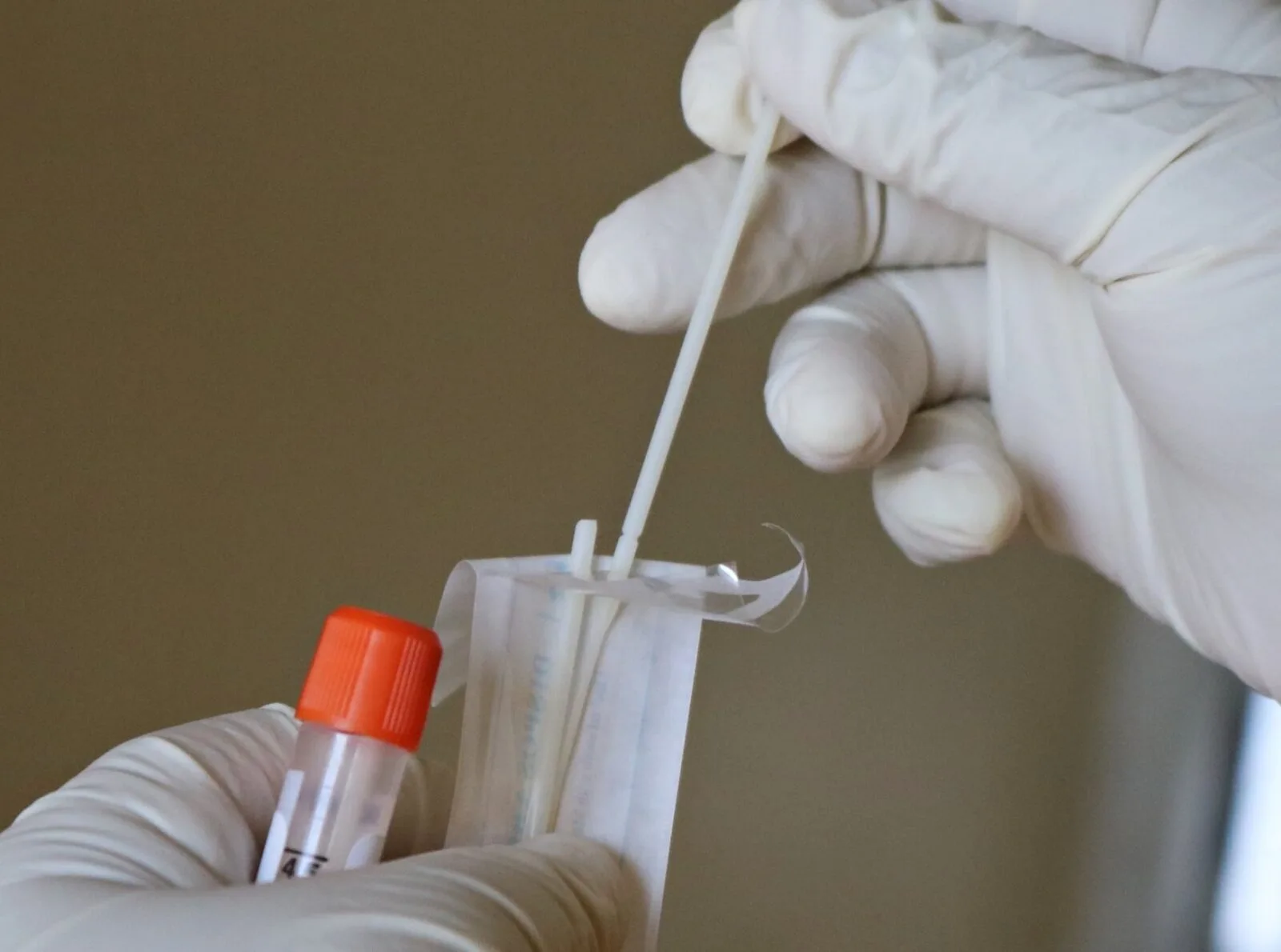 COVID Testing Scaled Back as UK Records Zero Deaths – Routine Checks End August 31