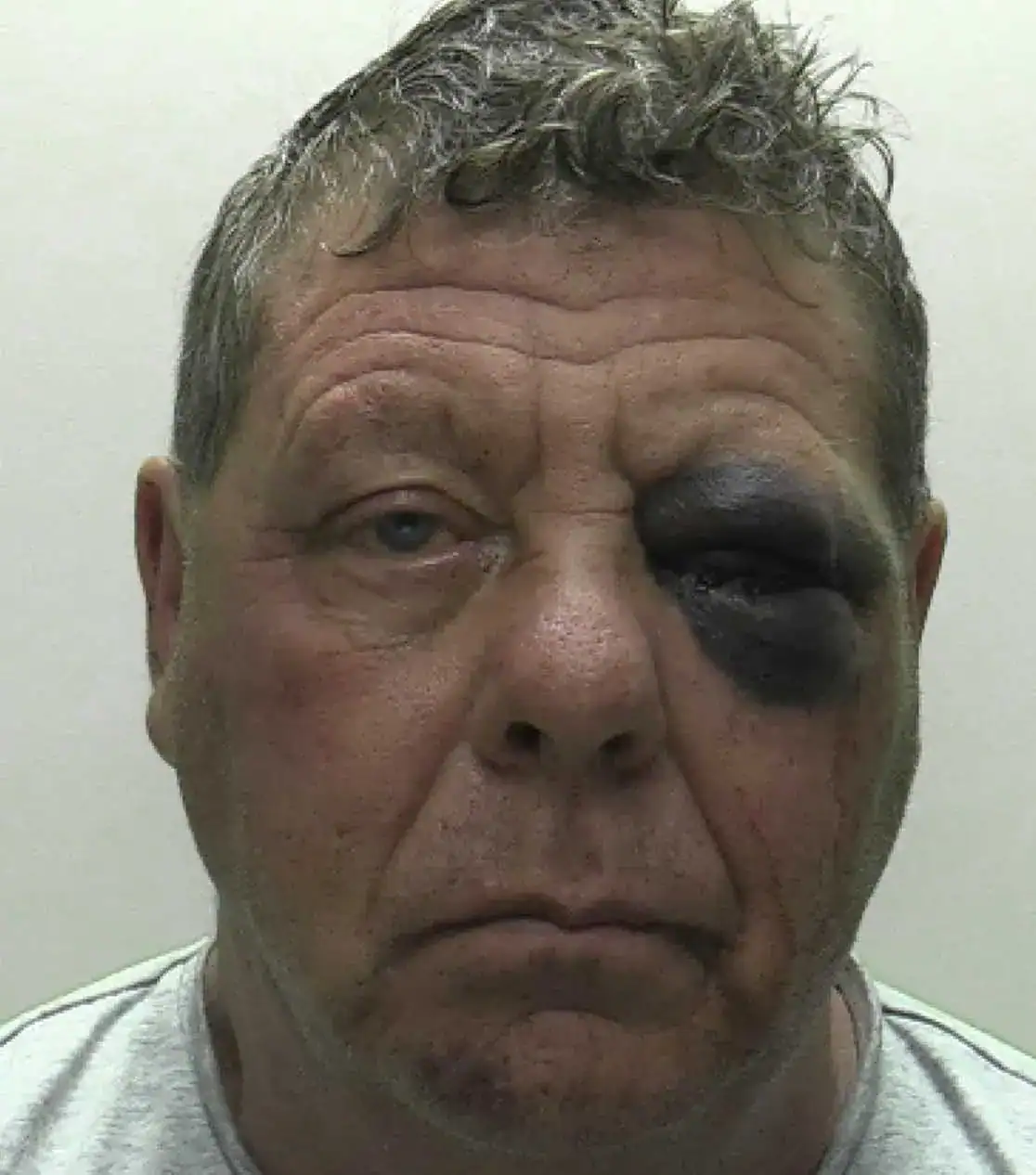 Princetown Knife Rampage: Jon Ross Jailed 20 Years for Stabbing Two Police Officers and Historic Child Sex Abuse