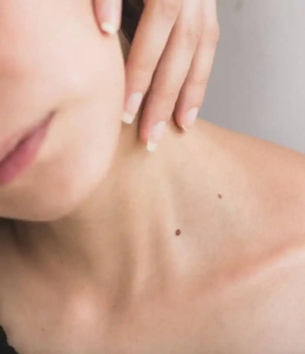 Toff Exposes Roaccutane Risks and Cosmetic Scams in Eye-Opening ITV2 Acne Doc