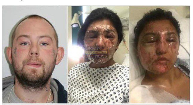 Nationwide Manhunt Launched After Horrific Acid Attack