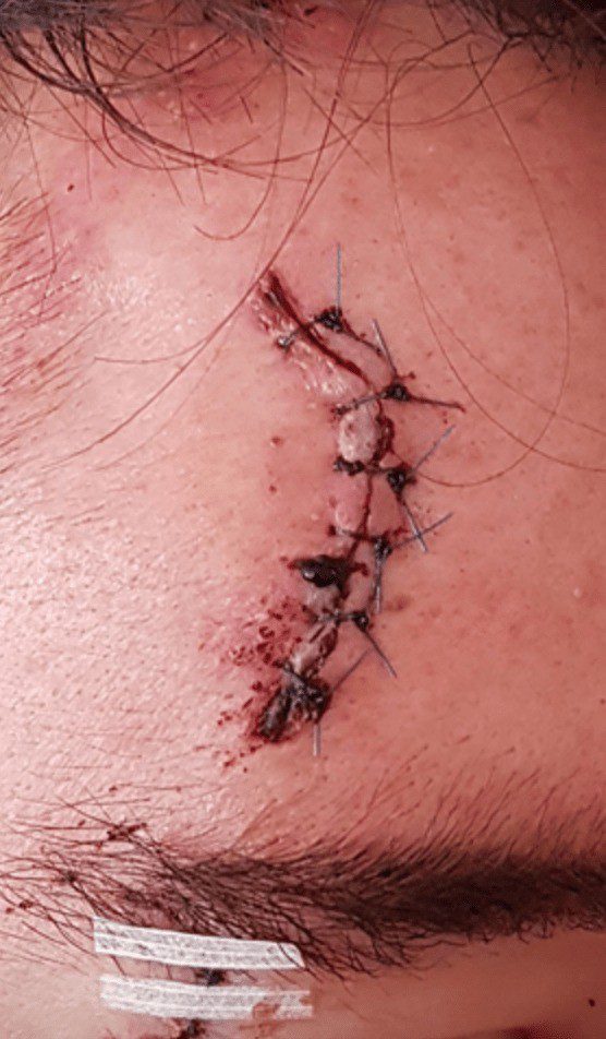 Police Hunt Puttenham Road Rage Attacker