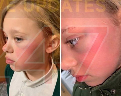 Nine Year Old Girl Attacked In Unprovoked Attack