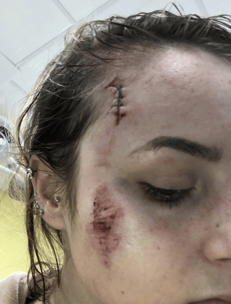 Warning After Woman Is Attacked In Folkestone Alley