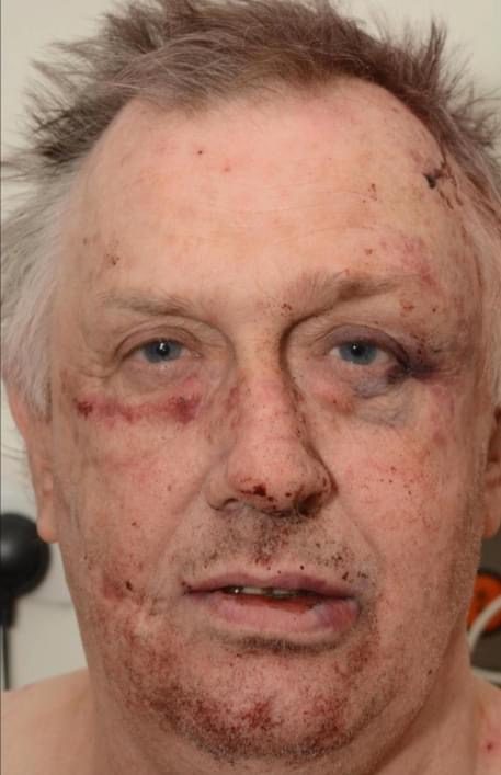 Evil Child Killer Roy Whiting Feared He Would Be Killed After Being Brutally Attacked In Prison With Makeshift Blades