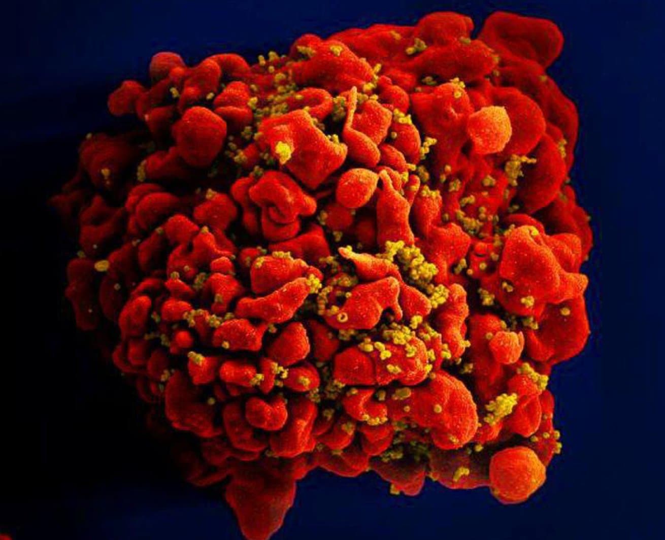 Doctors Say A Fourth Person Has Been Cured Of Hiv
