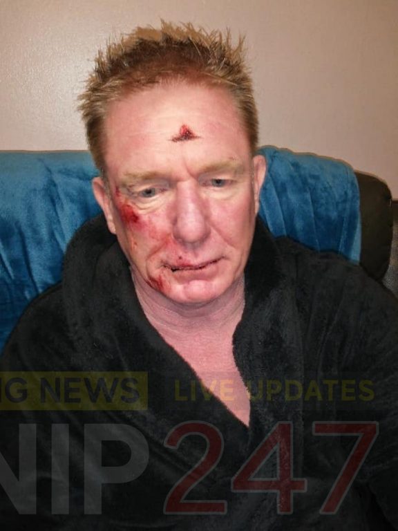 Three Yobs Leave Man With Facial Injuries