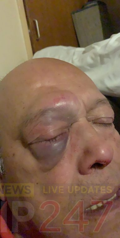 A Despicable, Cowardly Act As Scum Bags Attack Pensioner In Portsmouth