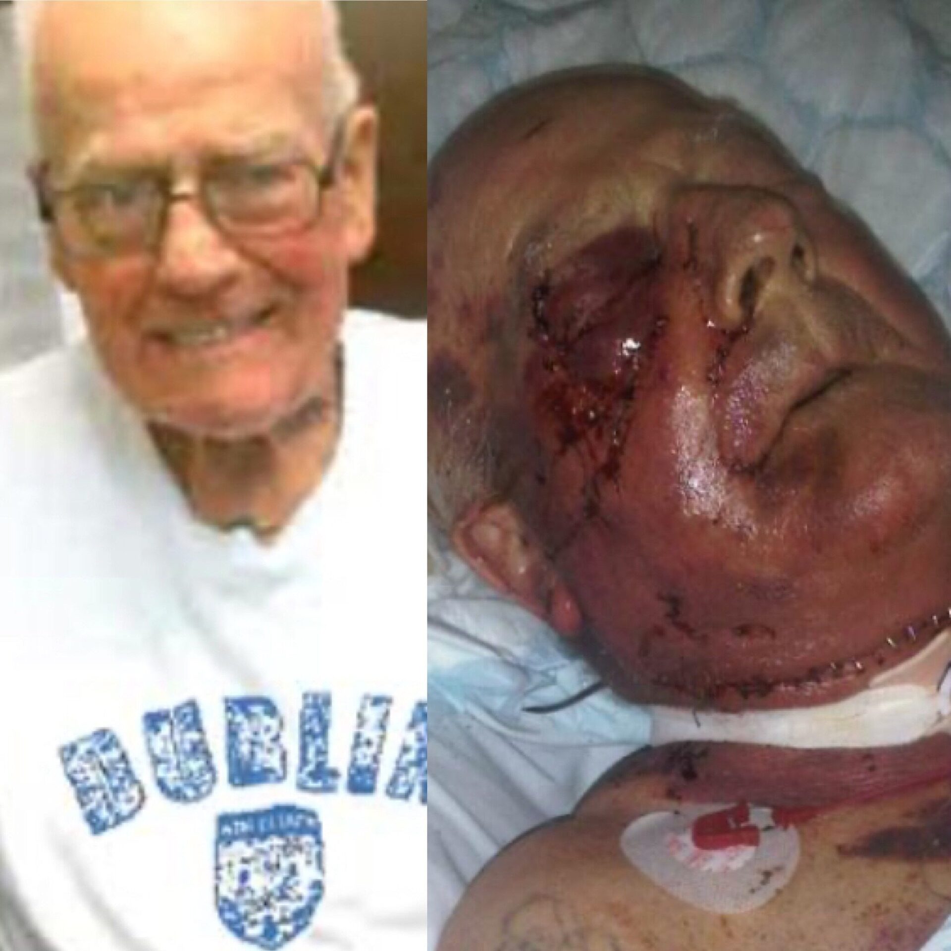 Eight Years On: Appeal For Information In Unsolved Assault On Elderly Man