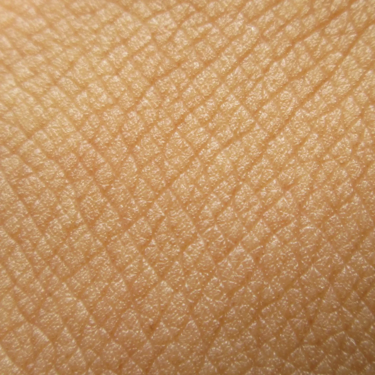 Breakthrough In Skin Regeneration: Wake Forest Researchers Bioprint Fully Functional Skin For Accelerated Healing