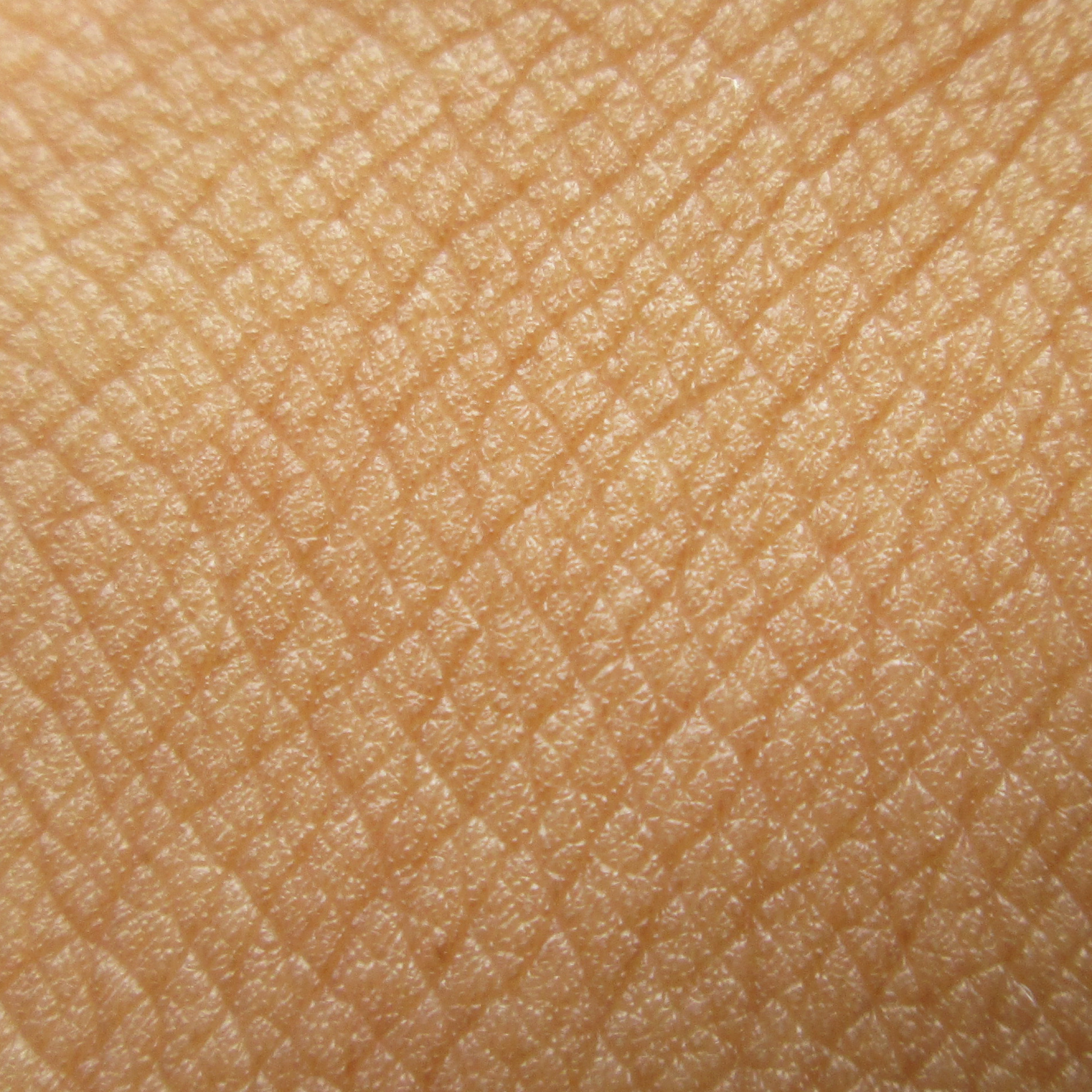 Breakthrough In Skin Regeneration: Wake Forest Researchers Bioprint Fully Functional Skin For Accelerated Healing