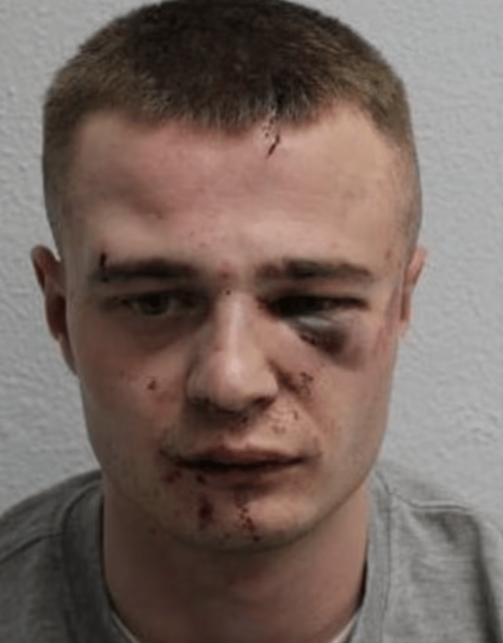 Man Jailed for Spate of Attacks on Three Women in 30 Minutes, Detained by Public in East London