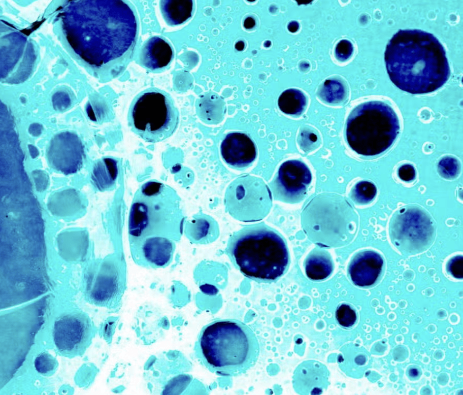 New Preventive Drug Licensed For Women At Increased Risk Of Breast Cancer