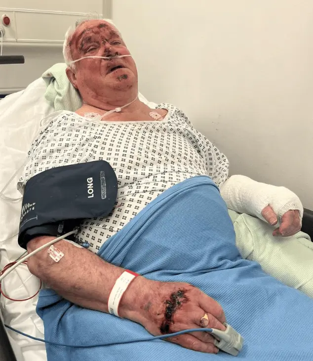 Urgent Appeal for Witnesses and Footage in Kings Heath Hit-and-Run Incident