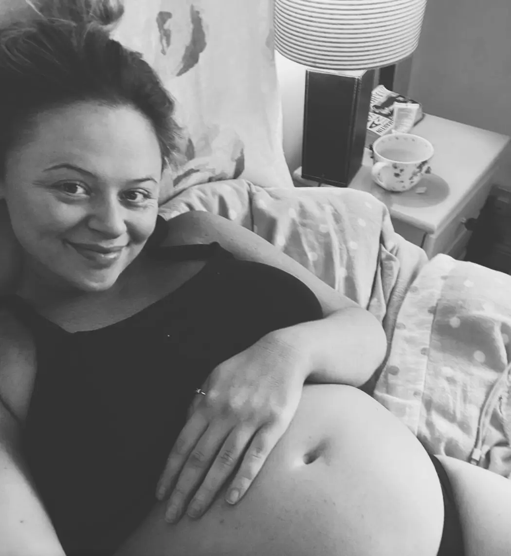 Emily Atack, Star of Inbetweeners, Announces Pregnancy with First Child