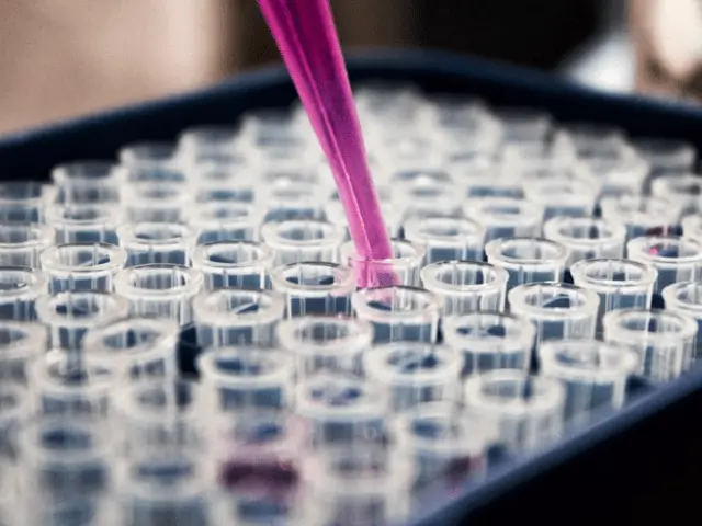 Intensity Modulated Proton Therapy (impt) Shows Promise In Oropharyngeal Cancer Treatment Intensity Modulated Proton Therapy (IMPT) Shows Promise in Oropharyngeal Cancer Treatment