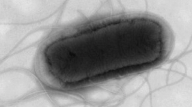 E. Coli Outbreak in the UK: What You Need to Know