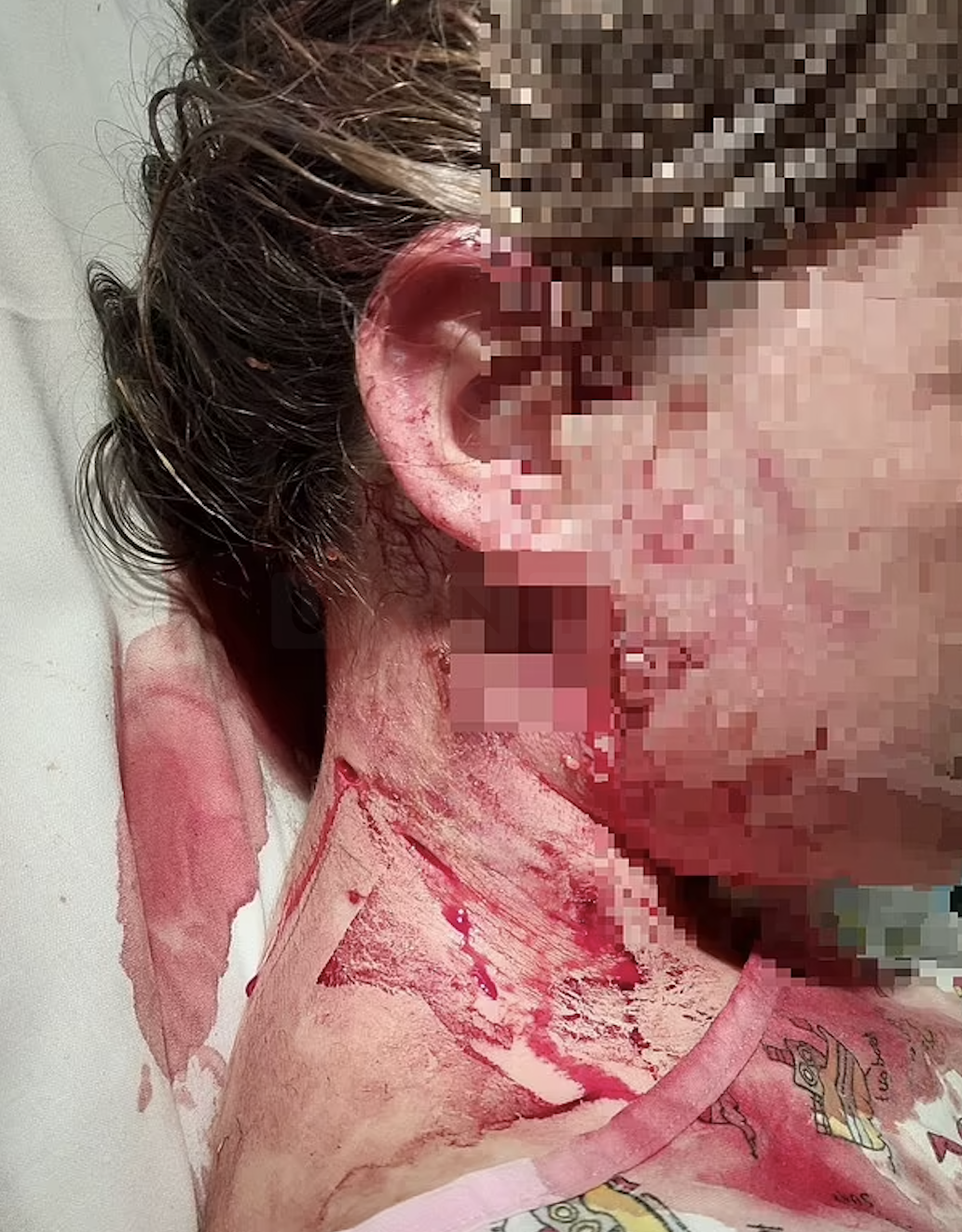 Tragic Dog Attack in South Yorkshire: Child Hospitalised, Three Arrested