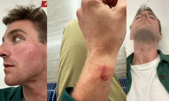 A special constable was attacked while intervening to stop a pickpocketing attempt targeting a female tourist on Westminster Bridge in Lo…