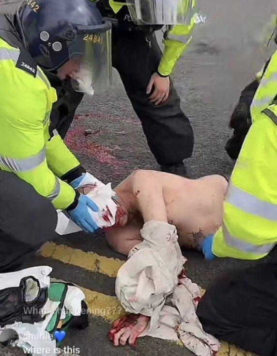 Hammer Attack on Protesters in Stoke by Masked Gangs