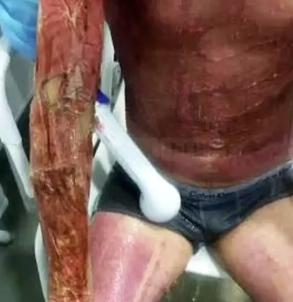 Man Thanks Paramedics Who Saved His Life After 11,000-volt Shock Incident Man Thanks Paramedics Who Saved His Life After 11,000-Volt Shock Incident