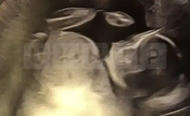 Mum and Baby Girl Die in Sleep in Lancashire Home