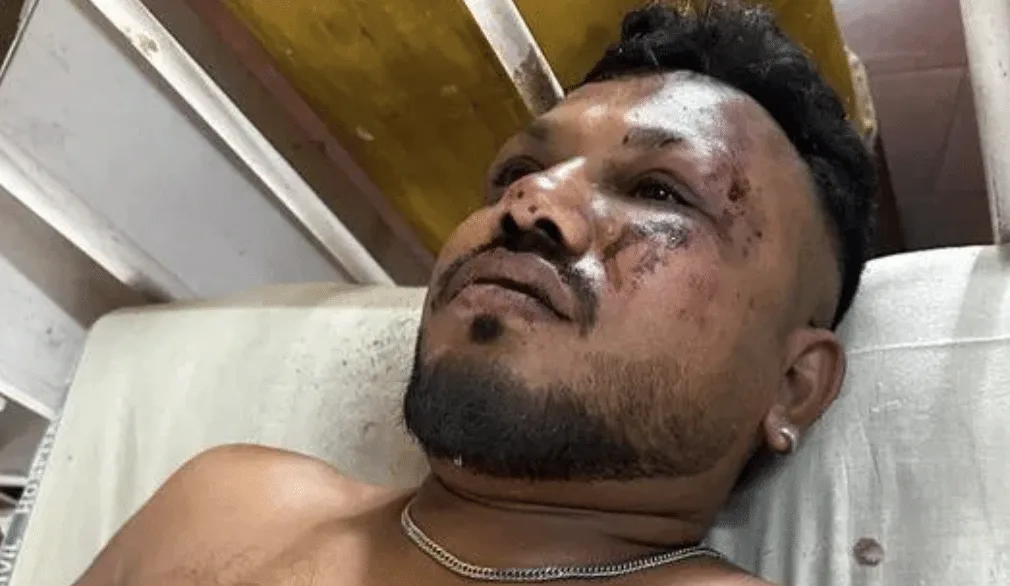 AirIndia Flight AI171: Black Box Recovered as Families Mourn Tragic Loss of 241 Lives in Ahmedabad Crash