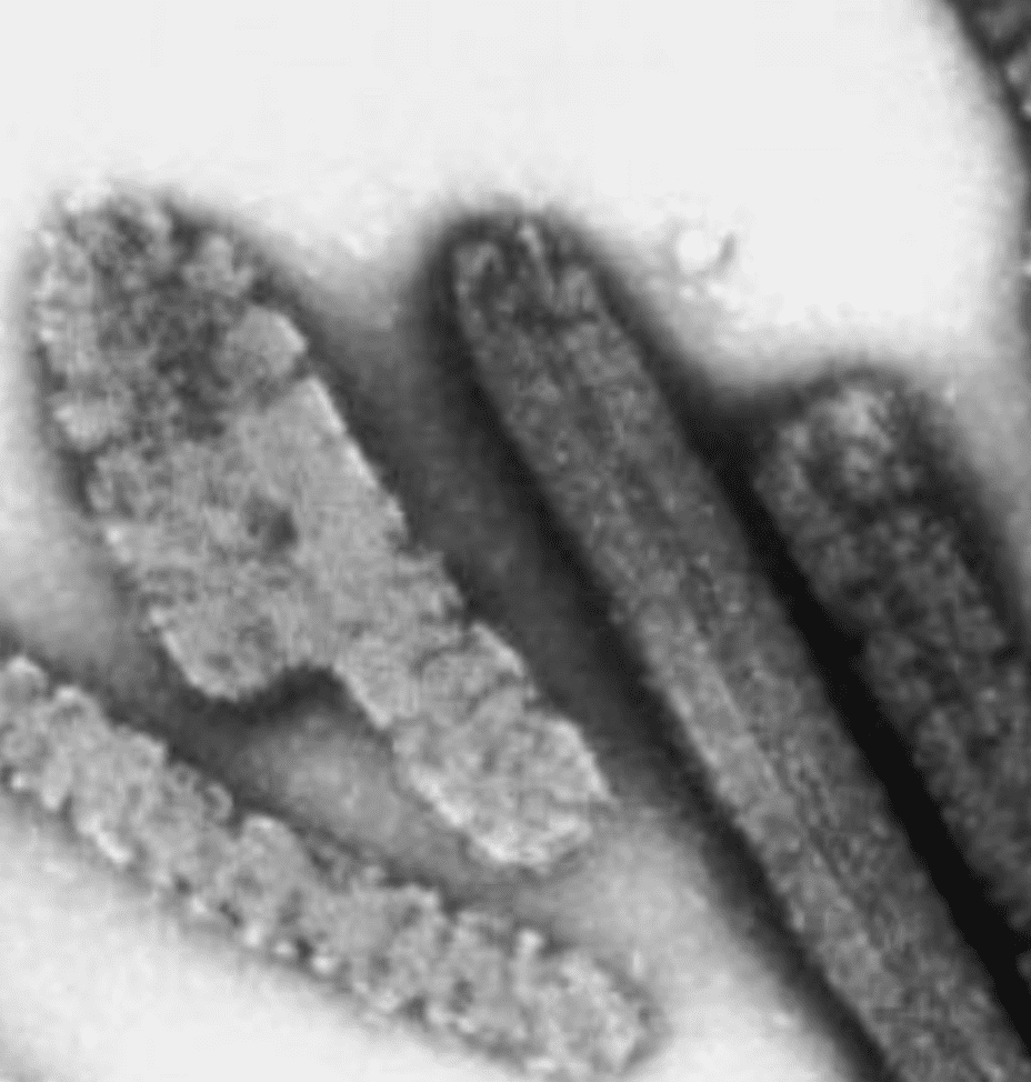 The World Health Organization (who) Announced On Thursday That Eight New Confirmed Cases Of The Deadly Marburg Disease Have Been Reported In Equatorial Guinea, Bringing The Total Number Of Laboratory-confirmed Cases To Nine And Probable Cases To 20