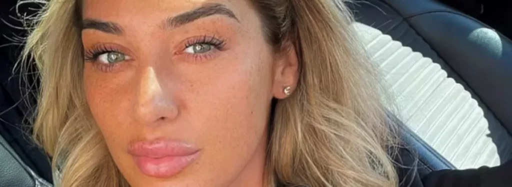 Connor Chapman Has Pleaded Not Guilty To Nine Offences, Including Murder And Attempted Murder, In Connection With The Shooting At The Lighthouse Pub In Wallasey Village On Christmas Eve 2022.