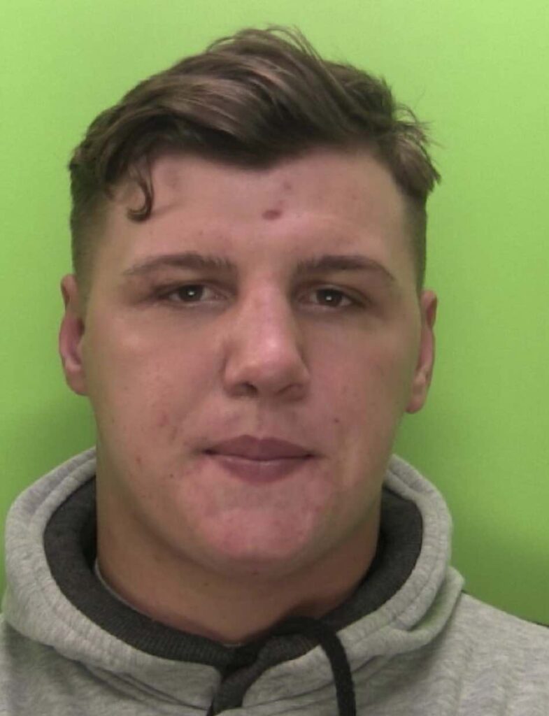 A Teenager Was Left Scarred For Life After Being Glassed By A Thug Who Flew Into A Rage When Topless Photos Of His Girlfriend Were Leaked