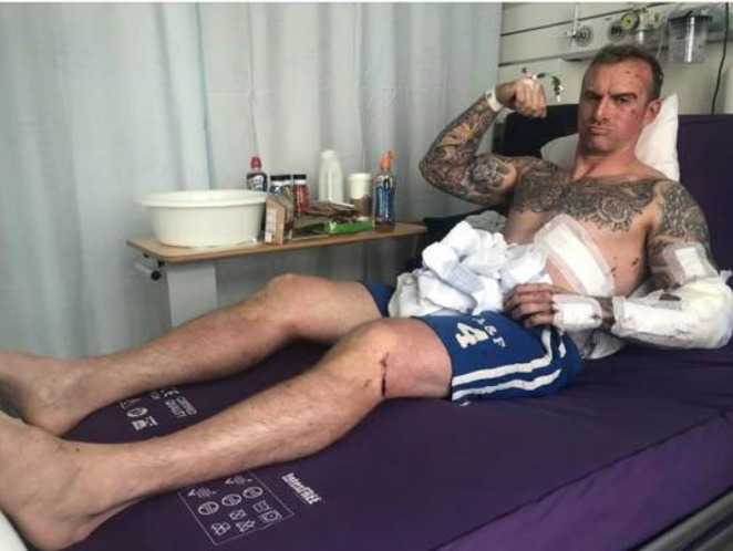 Firefighter Seriously Injured In Hit-and-run Incident In Corby