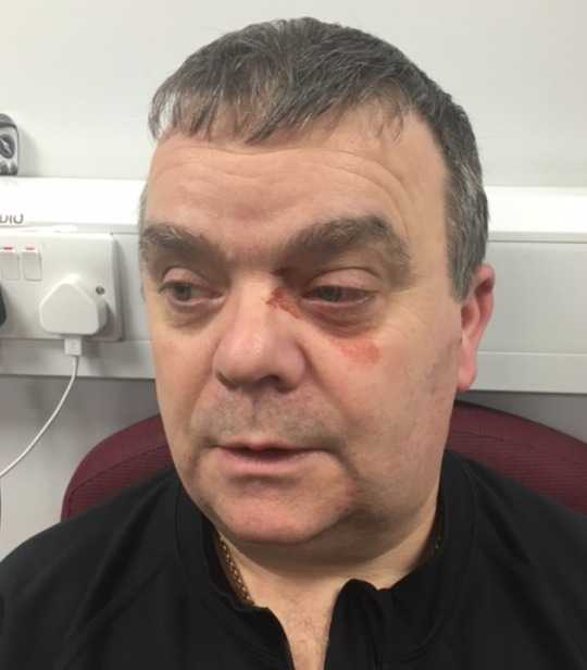Officer Feared For His Life After A Man He Was Arresting Tried To Gouge His Eyes Out