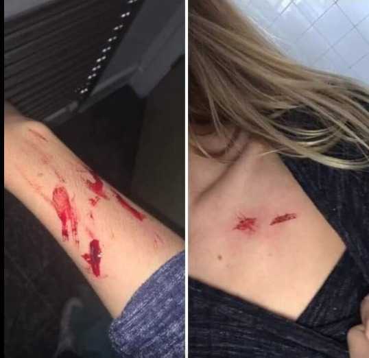 UPDATED:Manhunt launched after teenage girl Sex attack in Havant