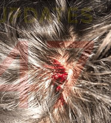 Charges brought  after Police Officer attacked with hammer in Twickenham