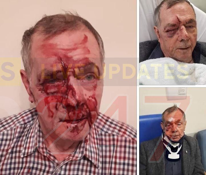 Scumbags who beat Pensioner to a pulp