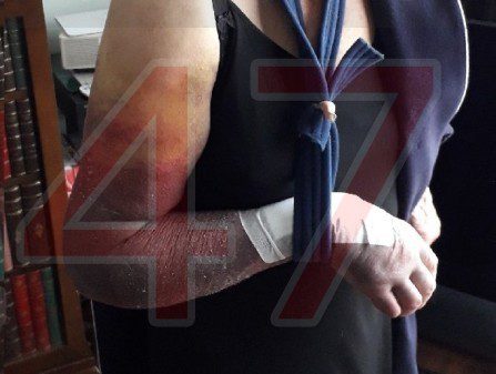 Pensioner attacked outside her own home after shopping trip