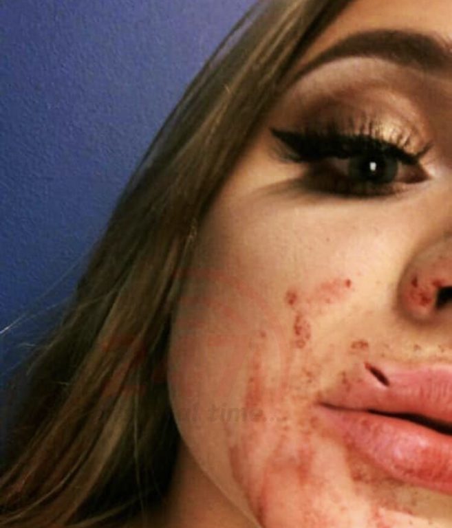 Woman needing hospital treatment after Oceana dance floor attack