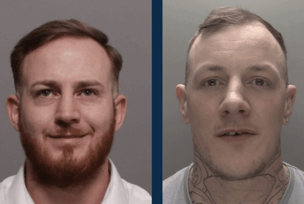 Cyclist Rushed to Hospital After Being Hit by Car in Bridgemary Gosport