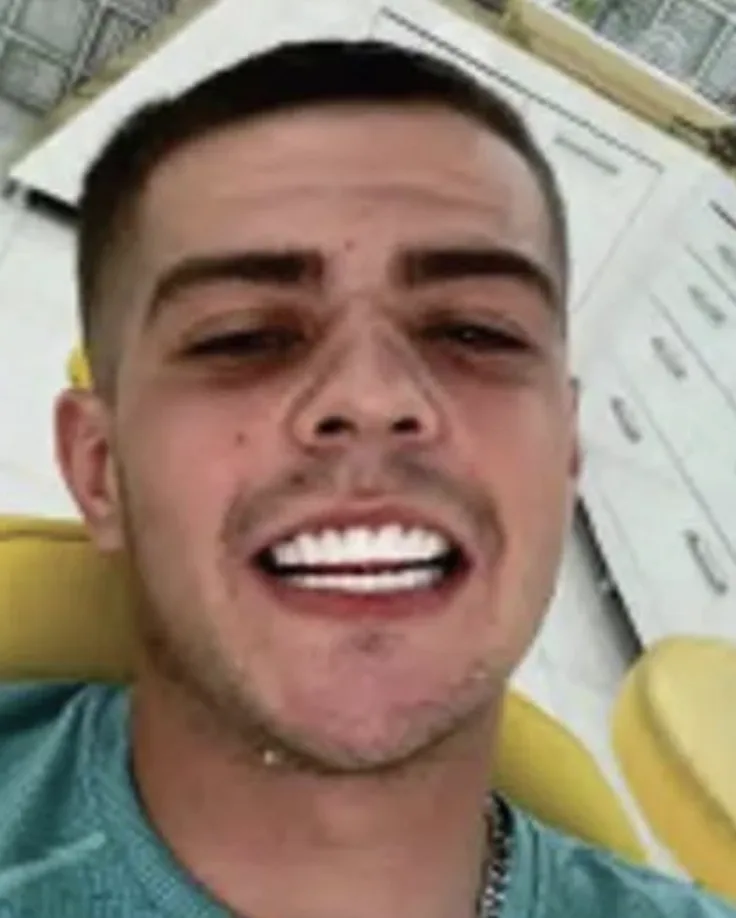 Grinning drug dealer Coran Davies was caught after sending a pal a selfie showing off his new ‘Turkey teeth’