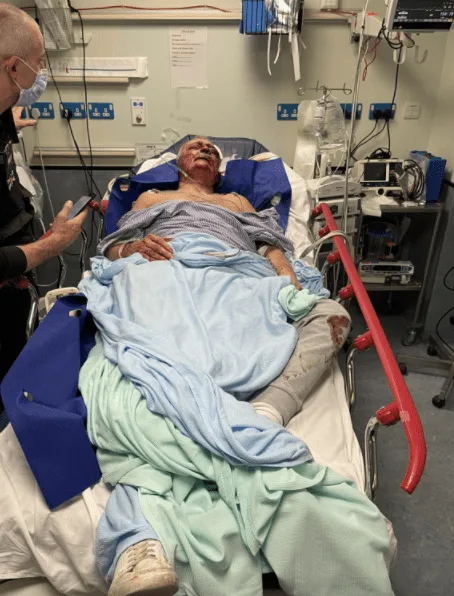 Thugs Snatch 12-Year-Old’s White BMC Bike in Bramley Park – Police Hunt Two Teens