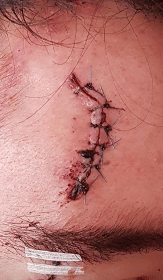 Police Hunt Puttenham Road Rage Attacker