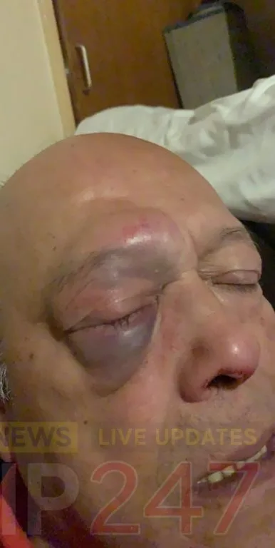 Pensioner Brutally Beaten in Portsmouth Home Invasion Sparks Outrage and Police Probe
